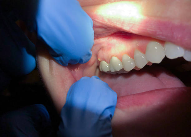 Best Weekend Emergency Dentist in Lincoln, MO