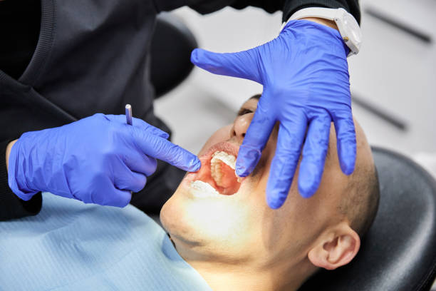 Best Emergency Tooth Extraction in Lincoln, MO
