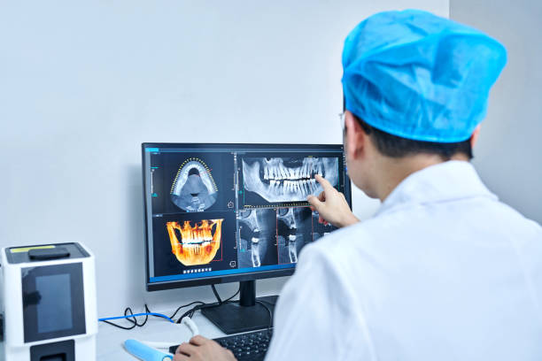 Best Emergency Root Canal Treatment in Lincoln, MO